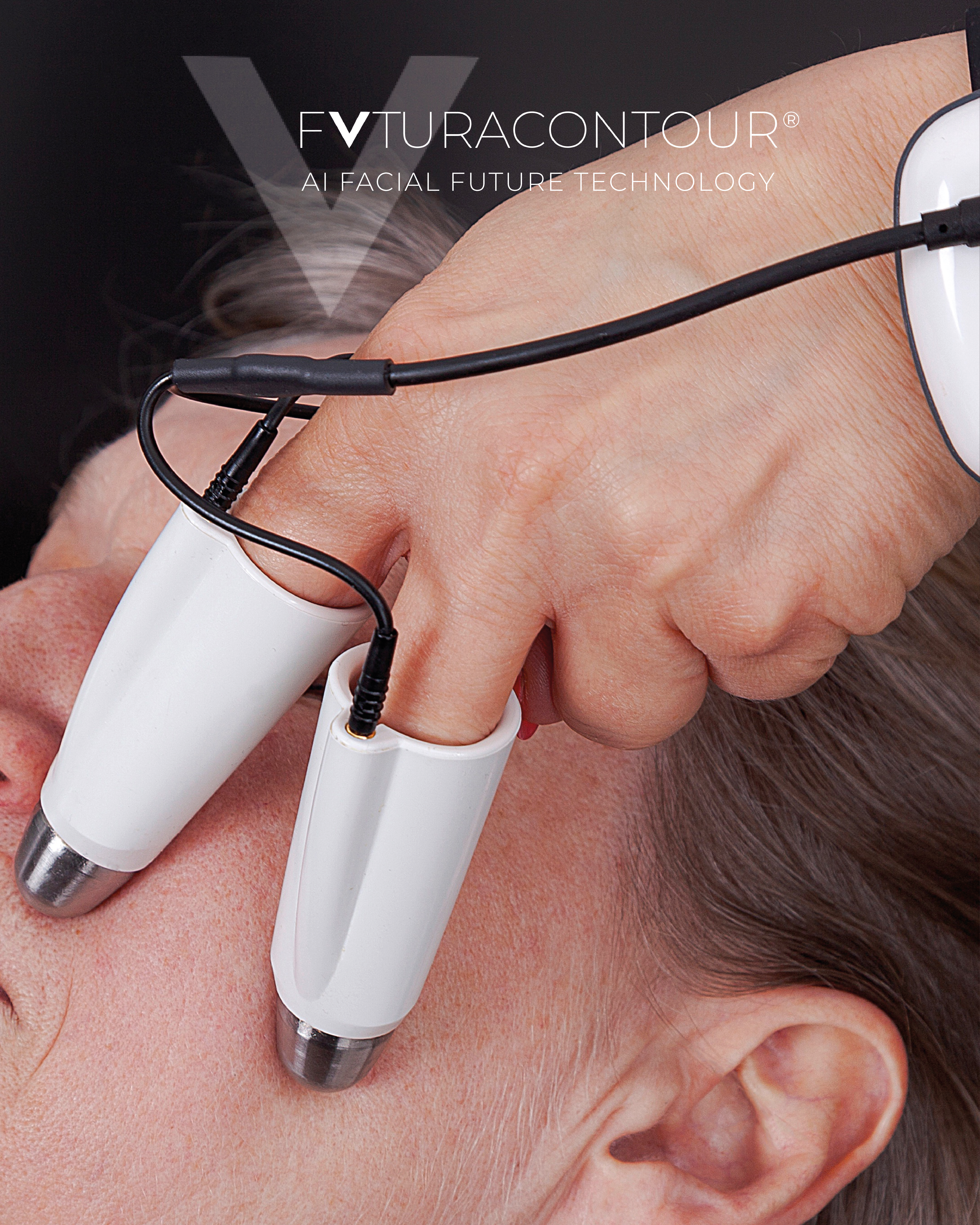 FUTURACONTOUR® – HAUTSTRAFFUNG & KONTOUREN- VERBESSERUNG im Charisma Beautycenter Neckarsulm