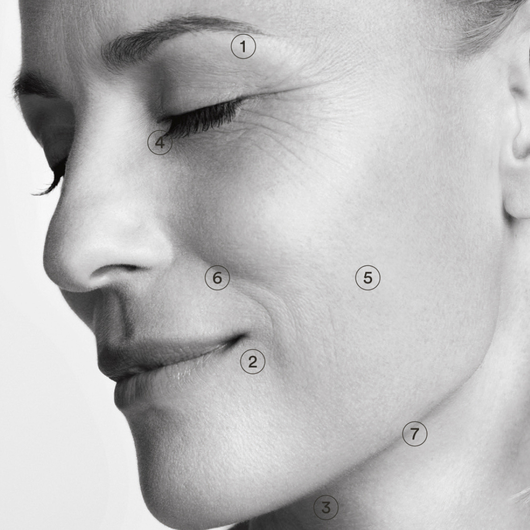 Vega – Nachhaltige Hautstraffung mit Radiofrequenz im Charisma Beautycenter Neckarsulm