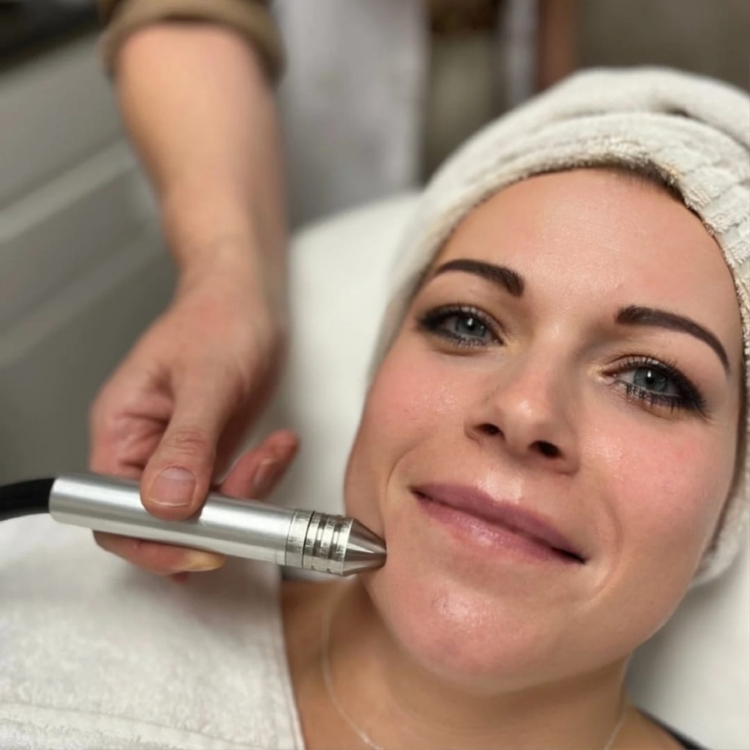 Microdermabrasion – Peeling & Hauterneuerung