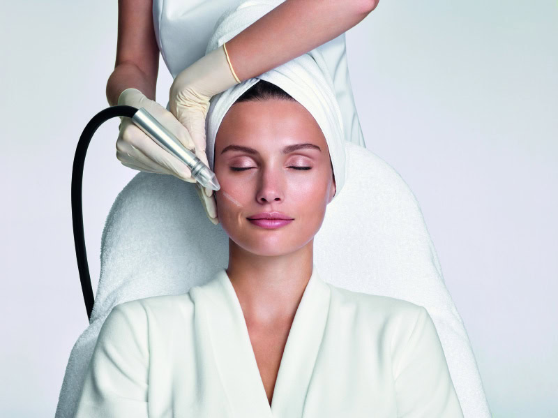 Microdermabrasion – Peeling & Hauterneuerung im Charisma Beautycenter Neckarsulm